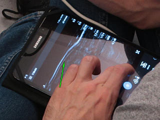 Ultrasound boundary layers